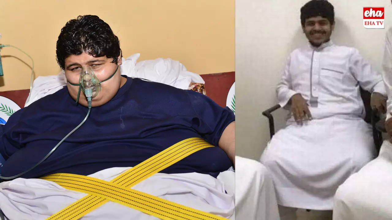 Saudi Man Loses Over 500 Kilos:రాజు సాయం చేశాడు..  600 కిలోల నుంచి 60 కిలోలకు తగ్గాడు!