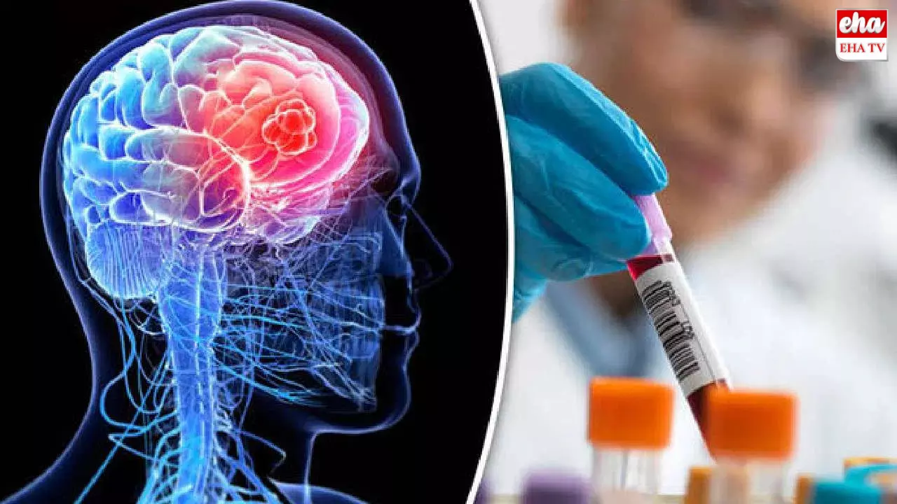 Brain Cancers:గంటలో మెదడు క్యాన్సర్‌ను గుర్తించే పరికరం