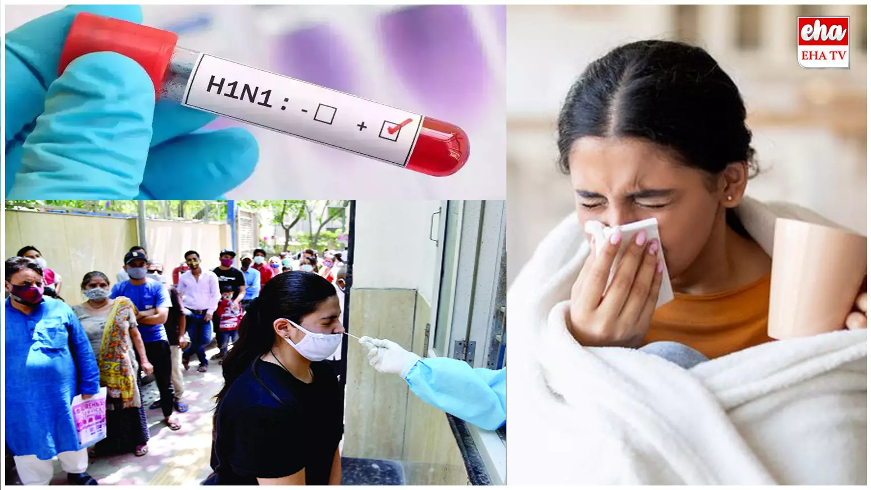 H1N1 and Influenza B Cases :  ఢిల్లీలో పెరుగుతోన్న స్వైన్‌ఫ్లూ కేసులు